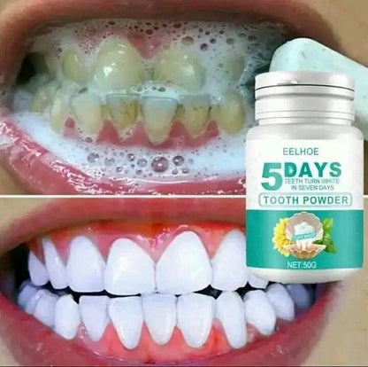 EELHOE 5 DAYS – Clareador Dental em Pó