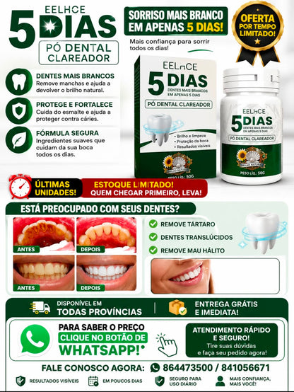 EELHOE 5 DAYS – Clareador Dental em Pó